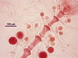 2  – Dettaglio delle tetrasporocisti inserite all’apice di pedicelli verticillati